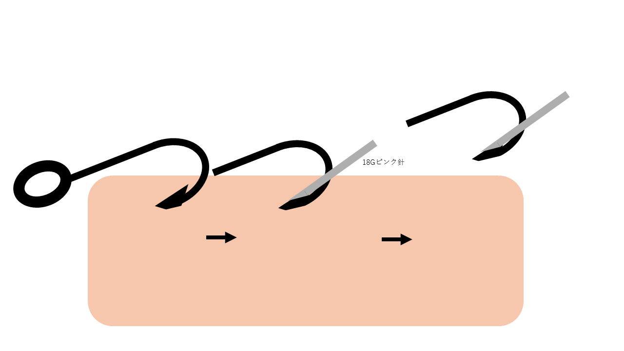 釣り針_18G